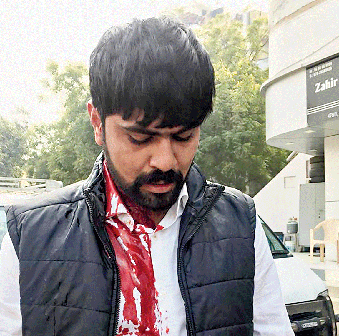 An injured student leader after the attack in Ahmedabad on Tuesday. 