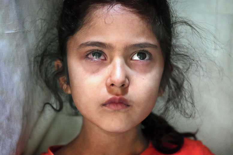 This photograph taken by Mukhtar Khan was among the 20 — 19 from Kashmir and one from Jammu, taken by three Associated Press photographers — which were chosen by the jury for the 2020 Pulitzer Prize for Feature Photography. The picture above shows six-year-old Muneefa Nazir, a Kashmiri girl, whose right eye was hit by a marble ball shot allegedly by paramilitary soldiers on August 12. When this picture was taken on September 17, 2019, the girl was standing outside her home in Srinagar. This photograph was published by The Telegraph also on its front page on September 27, last year.