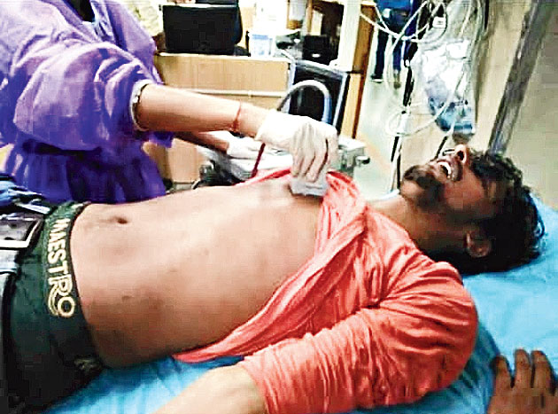 A blind student, Shashibhushan Pandey, knocked unconscious by a policeman. He was carrying a blind people’s white walking stick.