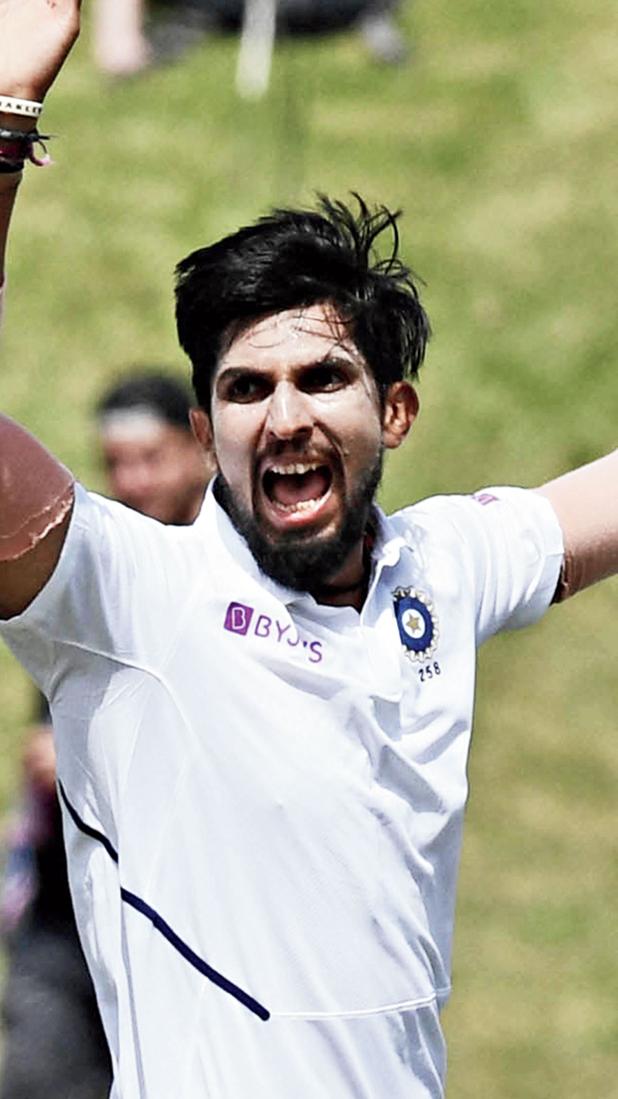 Ishant Sharma S Injury Flare Up Telegraph India