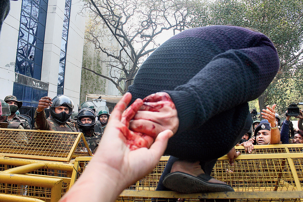 Shadab Farooq tries to cross police barricades to head for a nearby hospital on Thursday