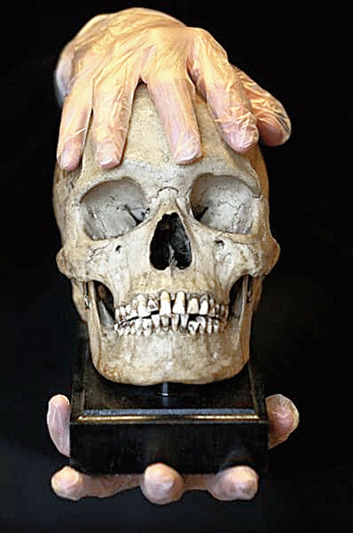 A Vedda skull