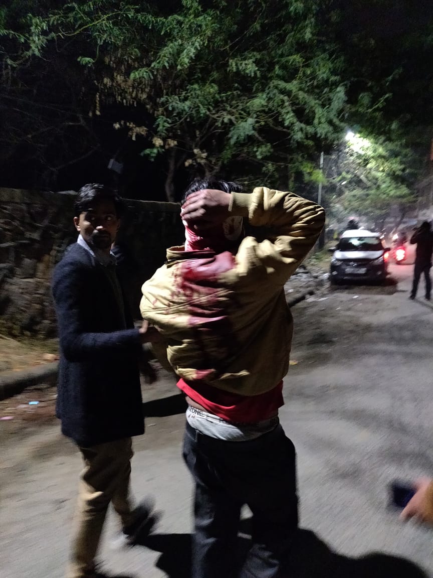 An injured student at Jamia Millia Islamia on Sunday, December 15, 2019. He could only say that the police barged in and started hitting students, before being led away to hospital